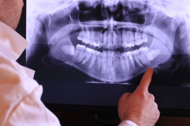 Best Teeth Whitening  in Sylvan Lake, MI